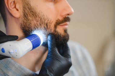 Trikoloğum dermatoskopi cihazıyla adamın sakal bölgesini inceliyor, cildini ve saç foliküllerini kontrol ediyor.