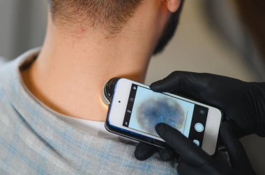 Doktor eldiven takıyor. Cilt kanseri taraması sırasında bir akıllı telefon ile hastanın arka boyun benini inceliyor.