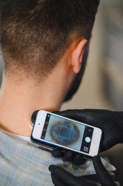 Doktor, cilt kanseri taraması ve tıbbi teşhis için akıllı telefon dermatoskobu kullanarak hastanın boynundaki beni inceliyor.
