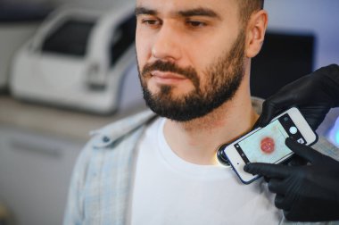 Doktor akıllı telefona takılı bir dermatoskop kullanıyor. Erkek hastanın köstebeğini potansiyel melanom için dikkatlice kontrol ediyor.