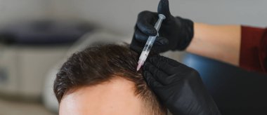 Bir klinikte mesoterapi gören saç dökülmesi hastası, saç büyümesini iyileştirmek ve yeniden büyümek için folikülleri canlandırmak.