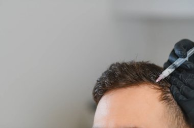 Bir trikoloğun saç kaybı ve yeniden büyüme tedavisi için kafa derisi enjeksiyonu alan hasta, sağlık ve yoğunluğu artırıyor.