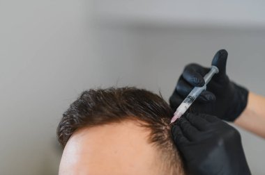 Trikoloğum saç büyümesini ve saç dökülmesini önlemek için hastanın kafa derisine vitamin enjekte ediyor.