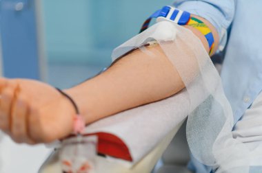 Kan bağışı sürecinden geçen iğneli bir insan kolu. Hayır işlerine, sağlık hizmetlerine ve hayat kurtarmaya odaklan.