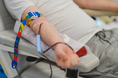 Bir klinikte kan bağışı yapan bağışçı sağlık hizmetlerine ve hayat kurtarma çabalarına katkıda bulunuyor. Kolu uzatılmış, damar içi iğne yerleştirilmiş.