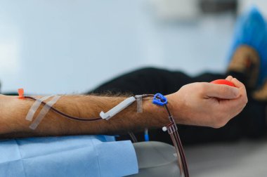 Kan bağışı yapan kişi, koluna iğne batırılmış, kan akışına yardımcı olmak için kırmızı stres topu sıkılmış. Sağlık ve hayat kurtarma kavramı