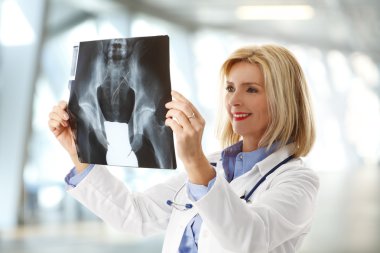 x-ray görüntü analizi 