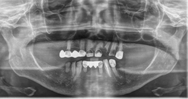 Raios Dentes Problema Mulher Idosa — Fotografia de Stock