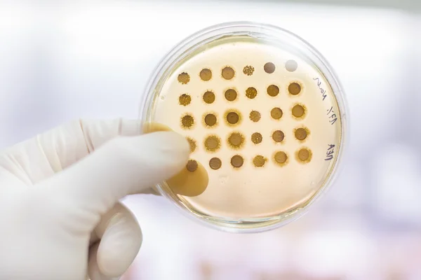 Fungi grown on agar plate. — Stock Photo, Image