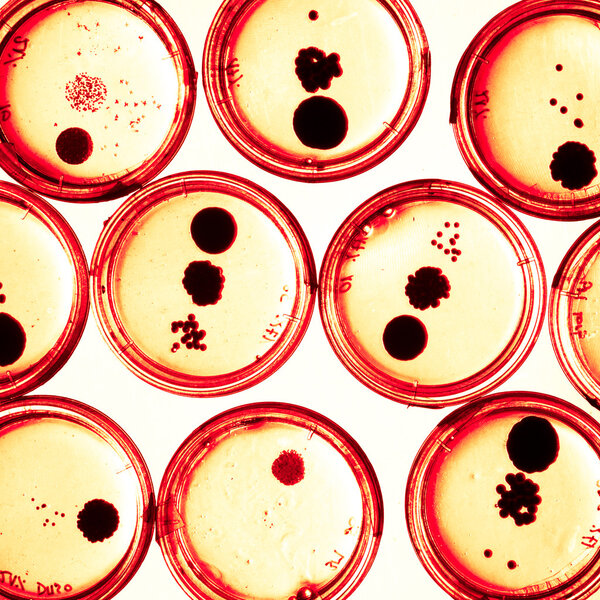 Growing Bacteria in Petri Dishes.