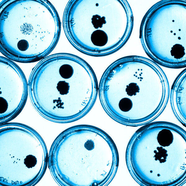 Growing Bacteria in Petri Dishes.