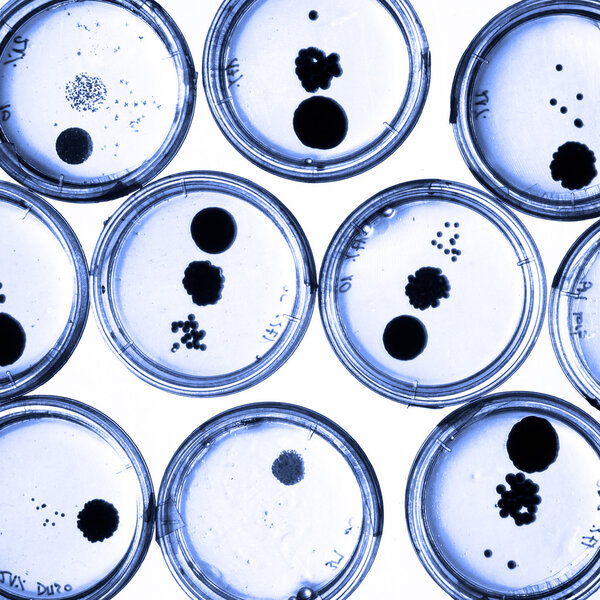 Growing Bacteria in Petri Dishes.