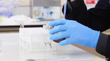 Doktor 'un Erkek Elinin Kapanışı Bir Tüp Sıvı Doldur