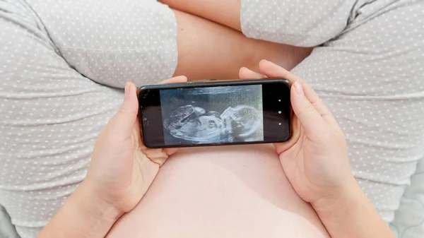 침대에 앉아 스마트폰으로 태어나지 않은 아기의 초음파 영상을 보고 있는 임신부의 모습 — 스톡 사진