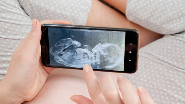 스마트폰 화면에 아직 태어나지 않은 아기의 초음파 이미지를 클로즈업 했습니다. 출산, 임신 및 건강 관리에 대한 개념. — 스톡 사진