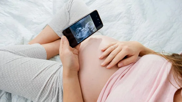Visão superior da mulher grávida segurando smartphone e olhando para a imagem de ultra-som de seu bebê por nascer na barriga. Conceito de esperar bebê, gravidez e cuidados de saúde. — Fotografia de Stock