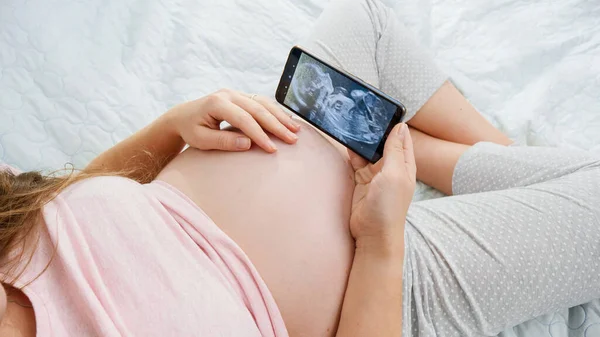 Jovem grávida de pijama navegando imagem ultra-sonográfica de seu bebê por nascer. Conceito de esperar bebê, gravidez e cuidados de saúde — Fotografia de Stock