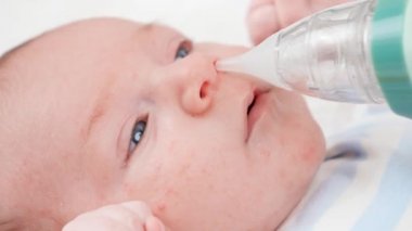 Yeni doğan bebek burnunu sümükten temizlemek için burun aspiratörü kullanma. Bebekler, yeni doğan hijyen ve sağlık hizmetleri kavramı. Küçük çocukları olan ilgili ebeveynler..