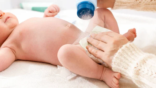 Primer plano de la madre aplicando talco en polvo mientras cambia pañales desordenados de su pequeño hijo bebé en el cambiador. Concepto de bebés e higiene y atención sanitaria del recién nacido. Cuidar a los padres con poco —  Fotos de Stock