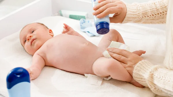 新生儿躺在换尿台上，母亲换尿布，在柔软的皮肤上涂滑石粉。婴儿和新生儿的卫生和保健概念。抚养幼儿的父母. — 图库照片
