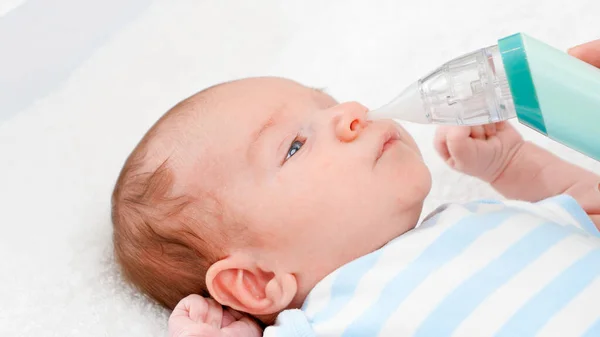 用电动鼻腔吸气器从新生婴儿鼻腔中取出粘液。婴儿和新生儿的卫生和保健概念。抚养幼儿的父母. — 图库照片