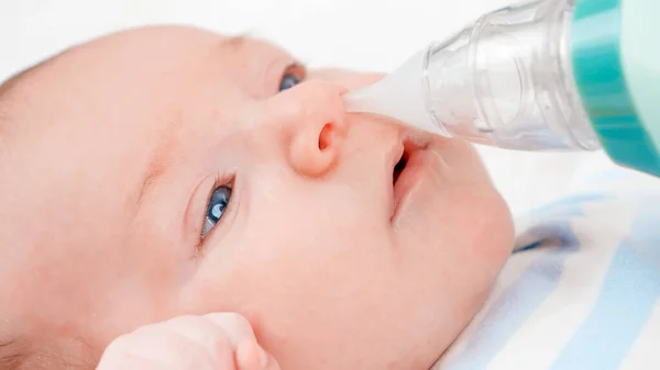 新生児の鼻を粘膜から洗浄するために鼻吸引器を使用することの閉鎖。赤ちゃんと新生児の衛生と医療の概念。小さな子供を持つ親の世話. — ストック写真