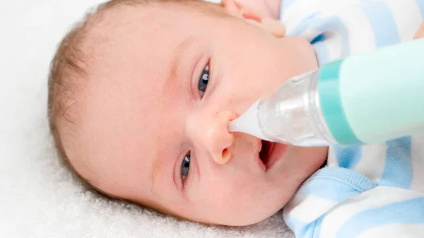 Nahaufnahme Zeitlupe der Reinigung der winzigen Nase eines Neugeborenen mit einem elektrischen Sauger. Konzept der Baby- und Neugeborenenhygiene und Gesundheitsfürsorge. Fürsorgliche Eltern mit kleinen Kindern. — Stockfoto