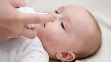 Deri iltihabından muzdarip bebek cildine nemlendirici krem sürme vakası. Yeni doğan bebek sağlığı ve cilt bakımı kavramı