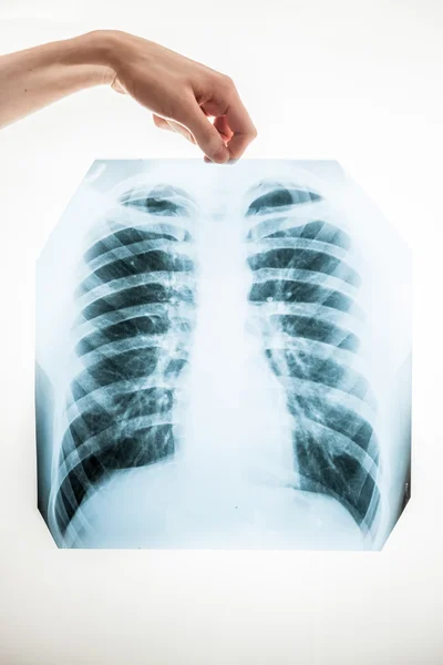 Closeup de homem segurando pulmões filme de raios-x sobre fundo branco — Fotografia de Stock
