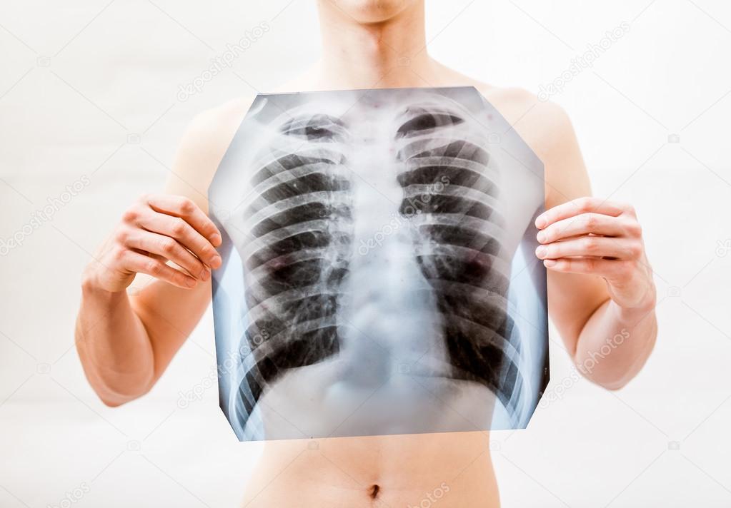 Closeup of young man holding x-ray of lungs over chest