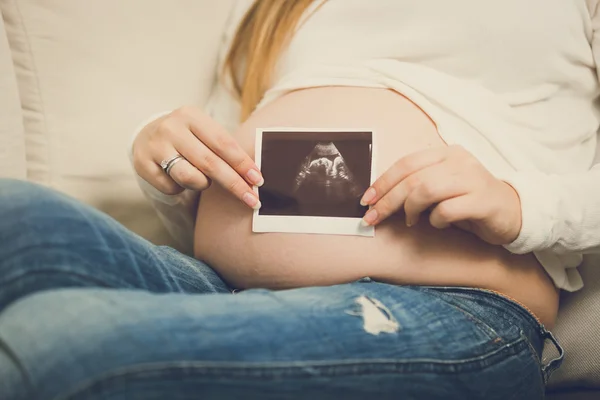 Toned photo of pregnant woman posing with ultrasound abode image — Stock Photo, Image