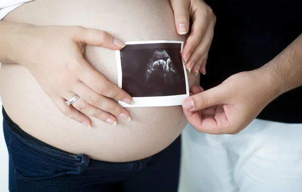 Closeup of young couple expecting baby holding ultrasound image — Stock Photo, Image