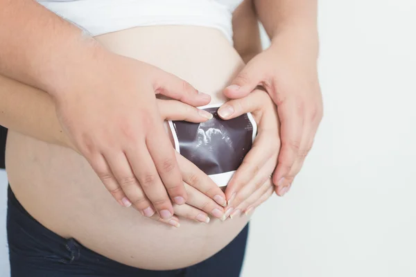 Conceptual photo of young couple expecting baby — Stock Photo, Image