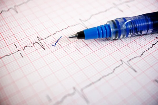 Électrocardiogramme en gros plan — Photo