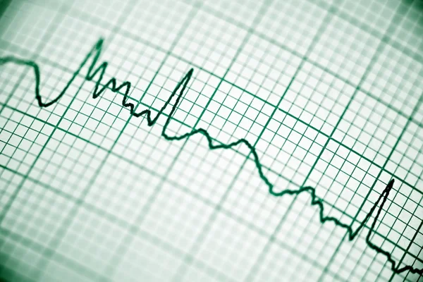 Electrocardiogram close up — Stock Photo, Image