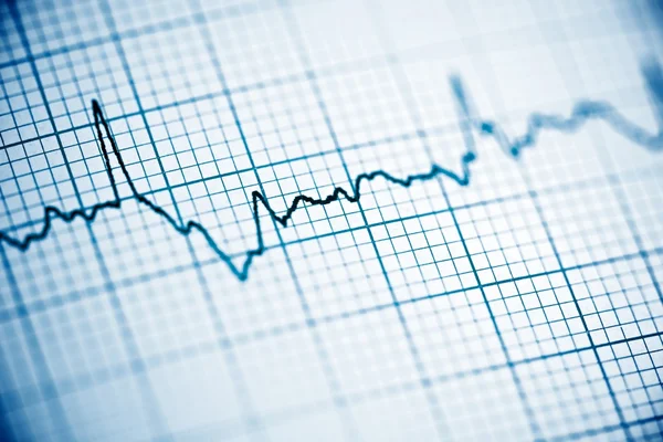 Electrocardiogram close up — Stock Photo, Image