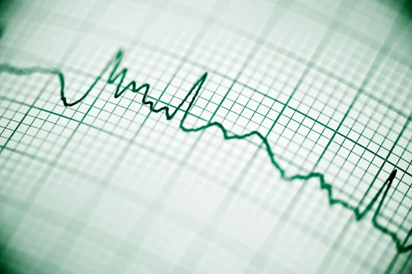 ELECTROCARDIOGRAMEN närbild — Stockfoto