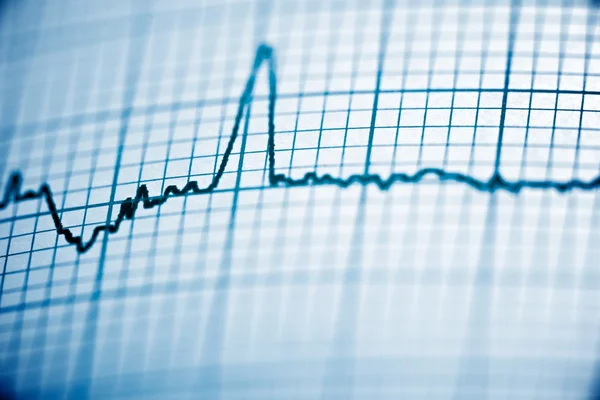 Electrocardiogram close up — Stock Photo, Image