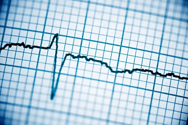 Electrocardiogram close up — Stock Photo, Image
