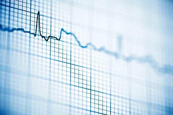 Electrocardiogram close up — Stock Photo, Image