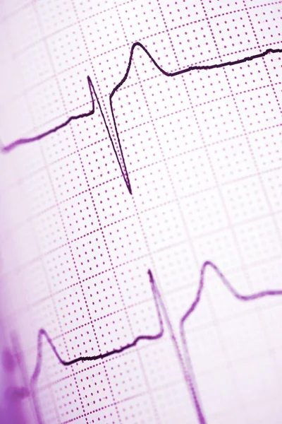 Close Electrocardiogram Paper Form — Stock Photo, Image