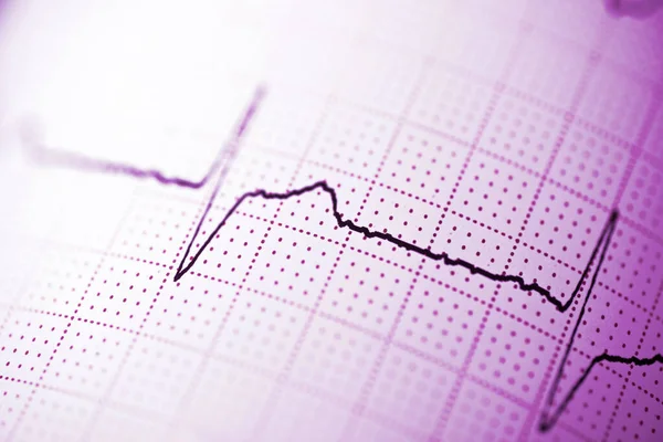 Primer Plano Electrocardiograma Forma Papel —  Fotos de Stock