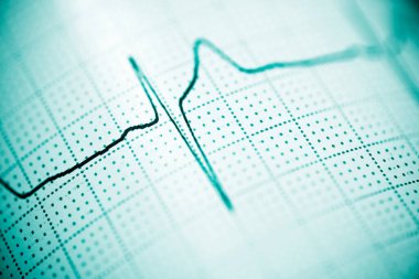 Elektrokardiyogramı kağıt formunda kapat.