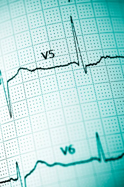 Close Electrocardiogram Paper Form — Stock Photo, Image