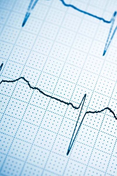 Primer Plano Electrocardiograma Forma Papel —  Fotos de Stock