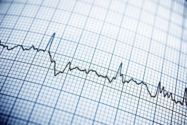 Electrocardiogram — Stock Photo, Image