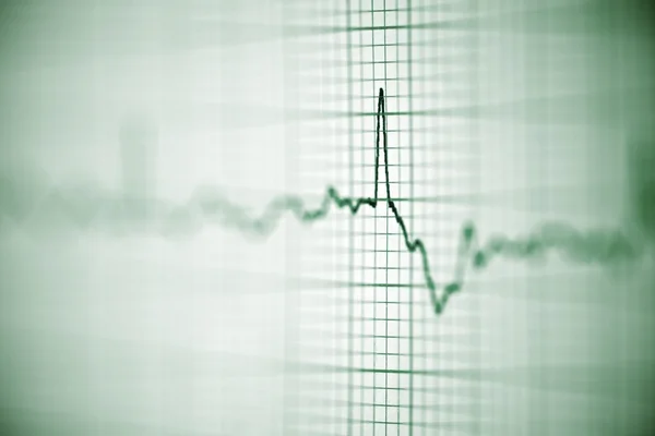 Electrocardiogram — Stock Photo, Image