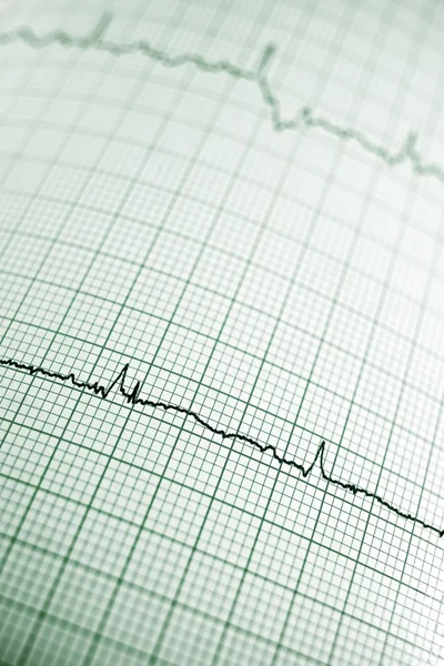 Electrocardiograma —  Fotos de Stock