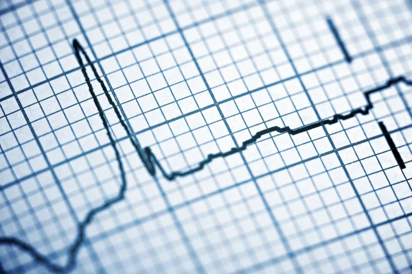 Electrocardiogram — Stock Photo, Image