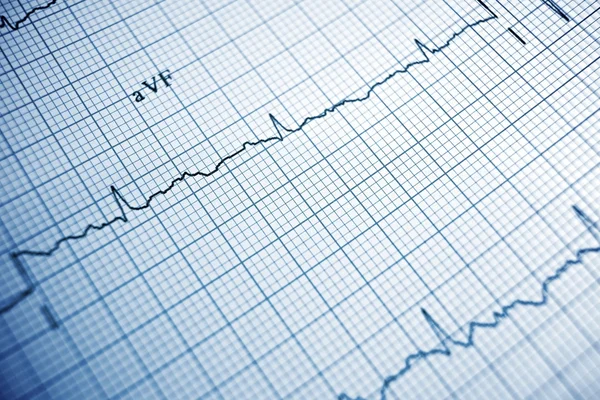 Electrocardiogram — Stock Photo, Image